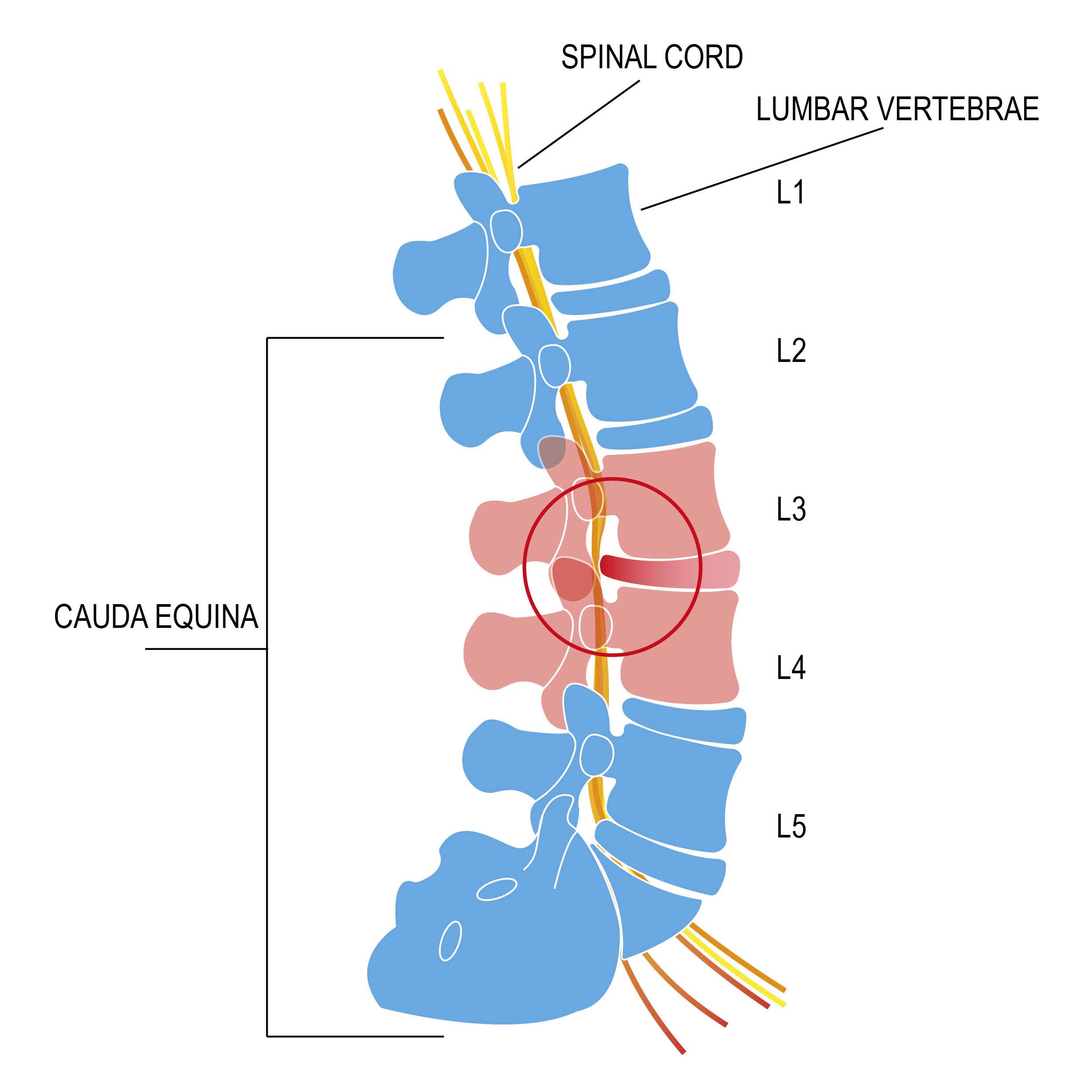 an annotated diagram of cauda equina